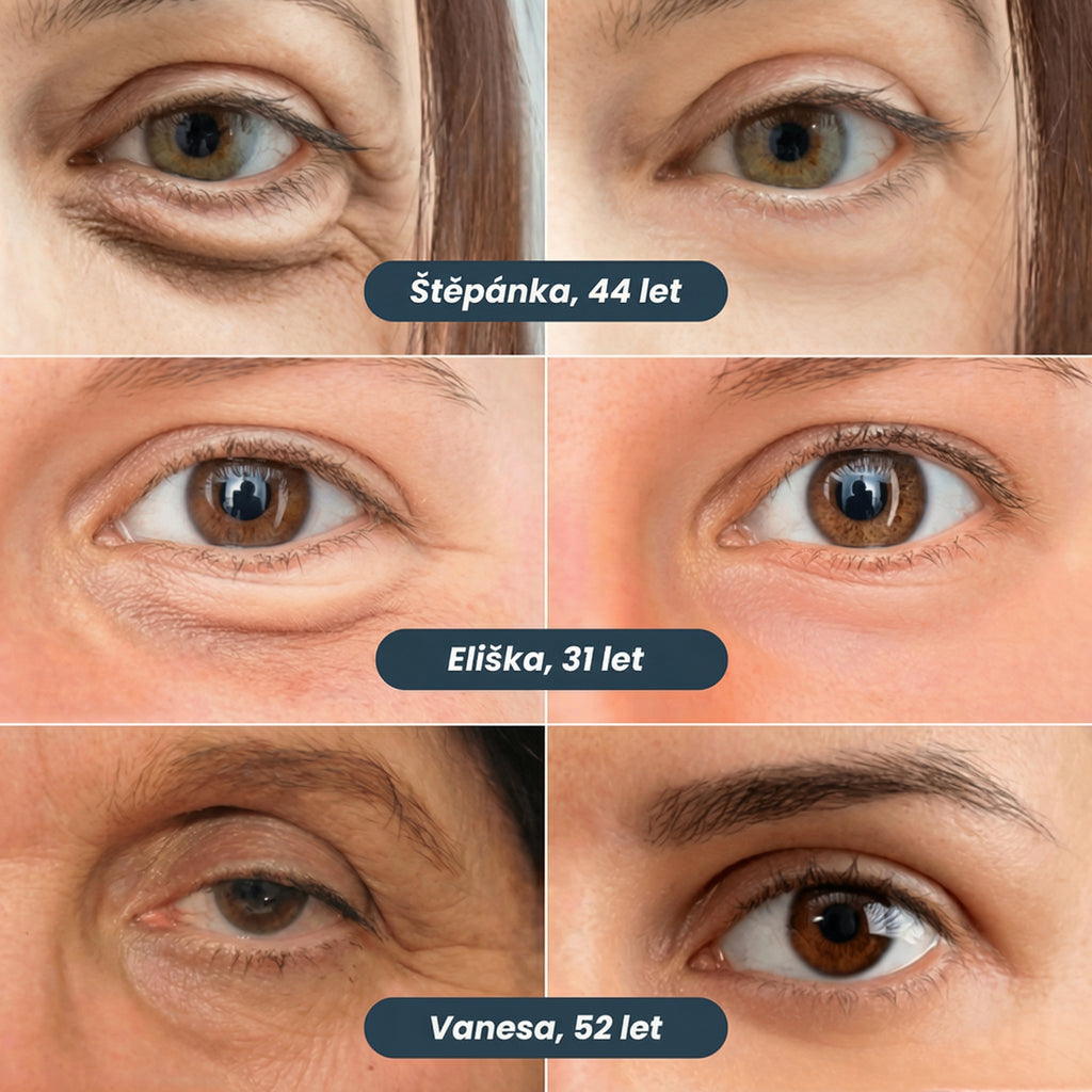 Patchy proti kruhům pod očima nové generace